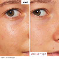 avant-apres-skin-fr-therapy