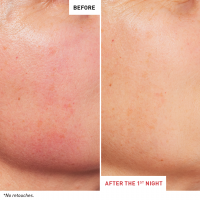 before-after-skin-therapy-uk